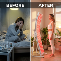 LuminaCore Radiance Panel — Before & After